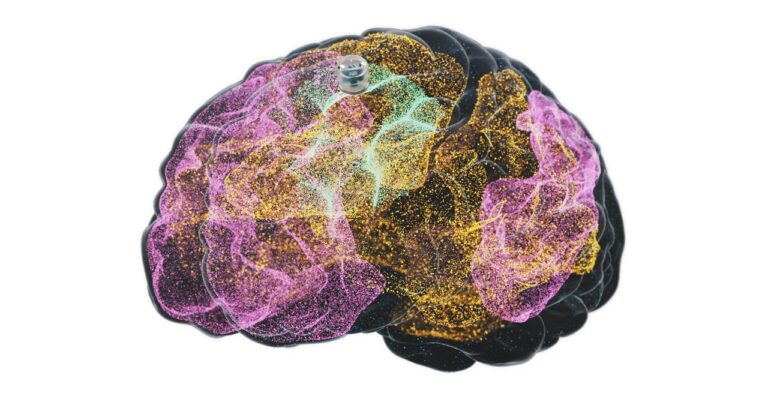 Avance en Salud Mental: Implante Cerebral para Tratar la Depresión